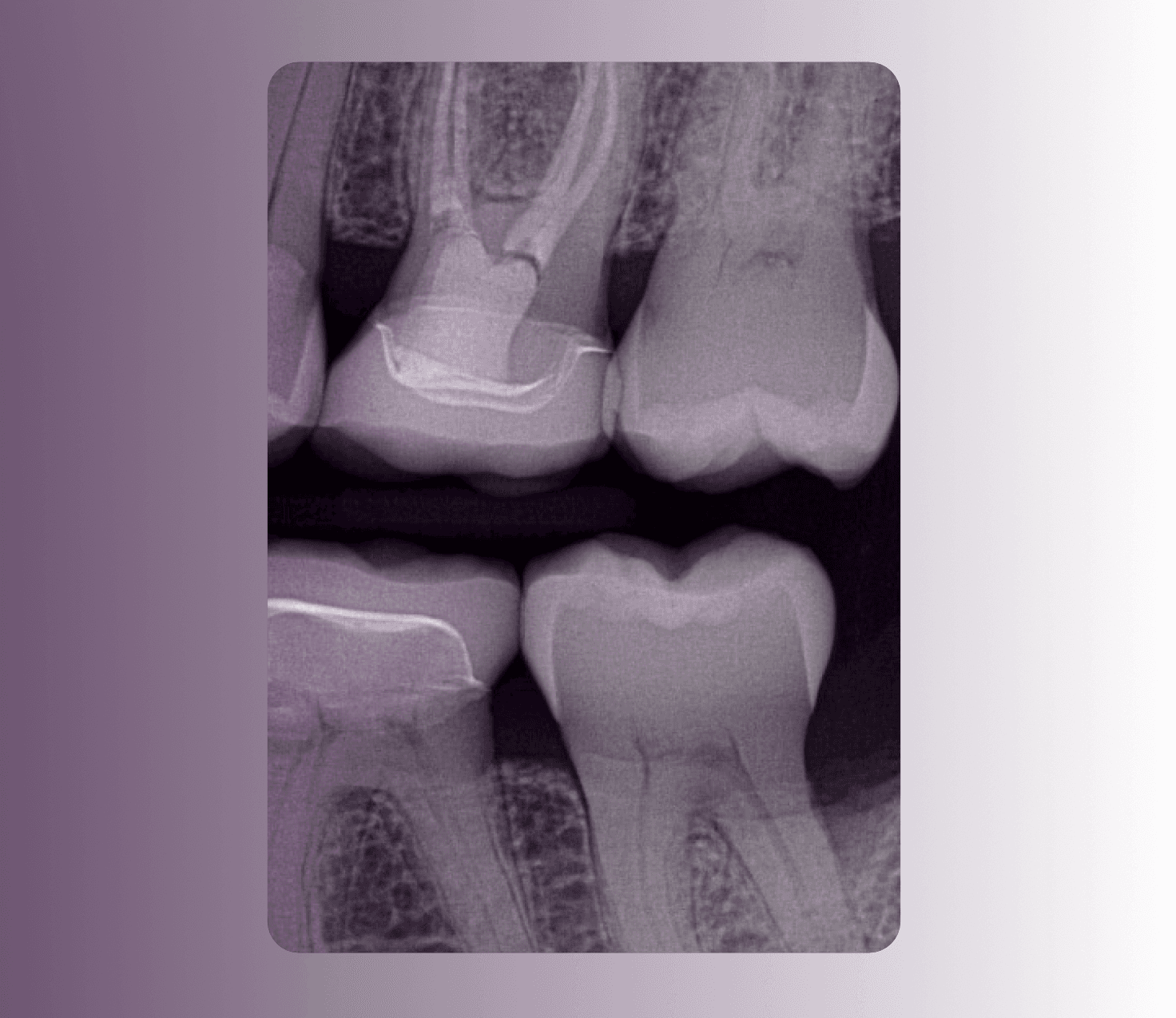 Cover Image for Diagnostic Radiographs for Perio